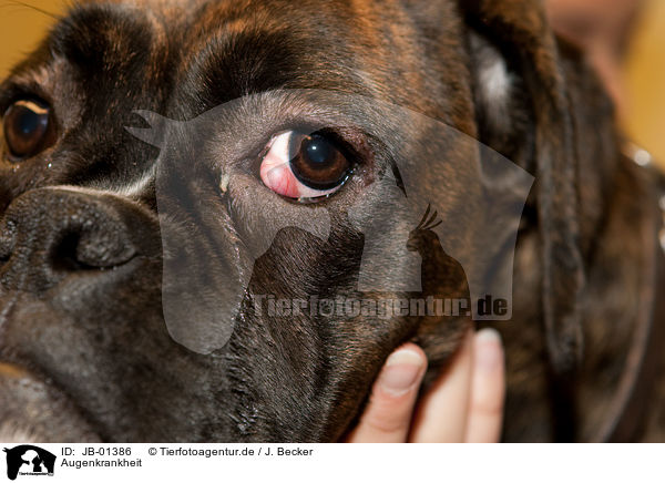 Augenkrankheit / eye disease / JB-01386